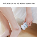 Electric Foot Vacuum Callus Remover - Front View